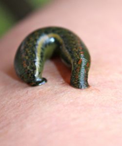 blood letting therapy using leeches